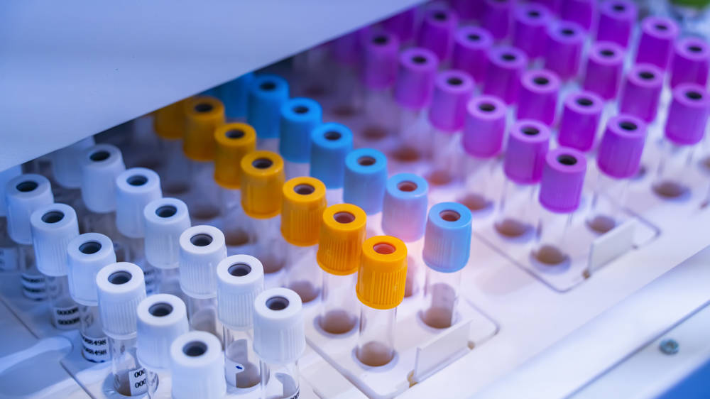 Istock 1355093075 Istock 1355093075