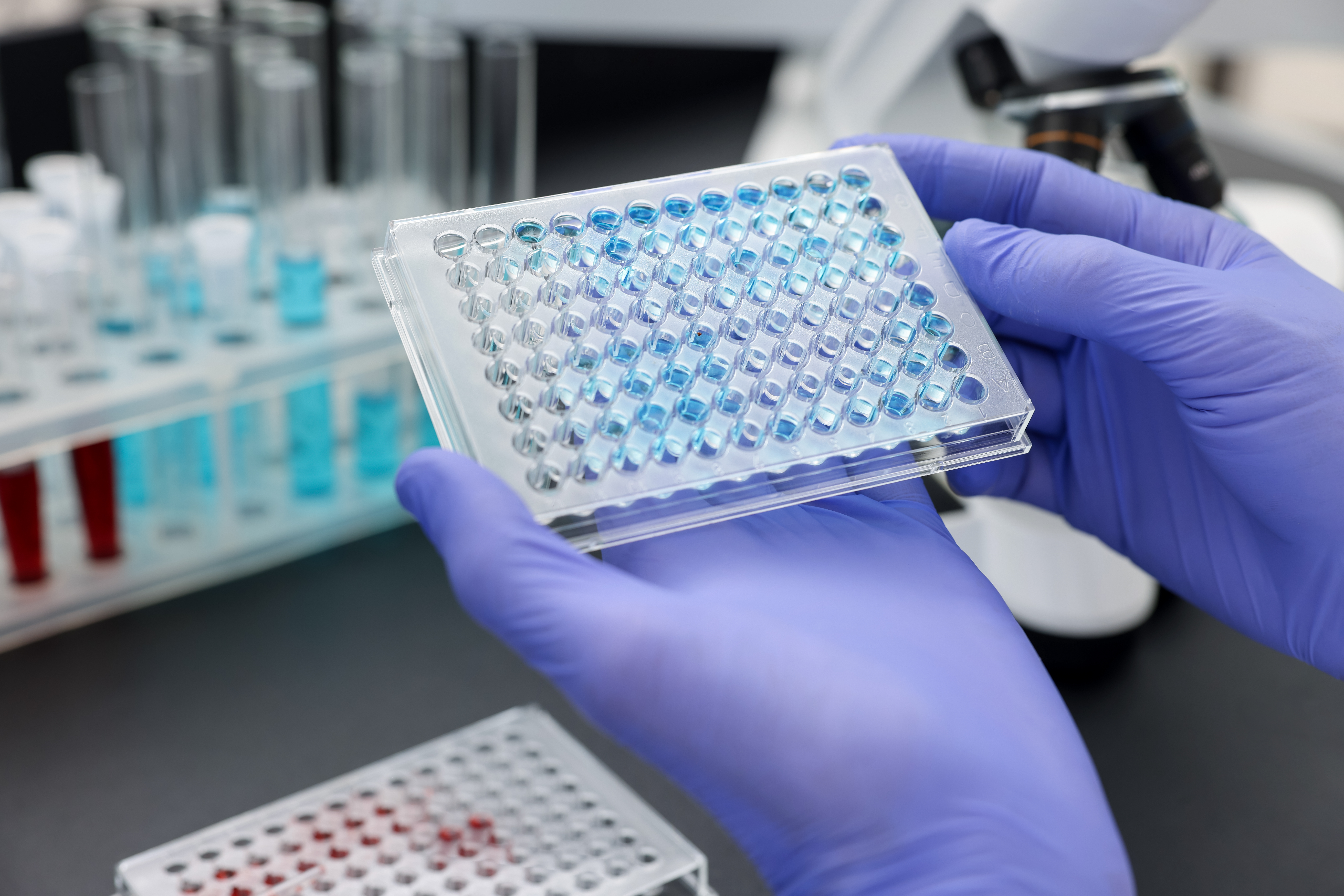 Adobestock 1749236181 Microplate